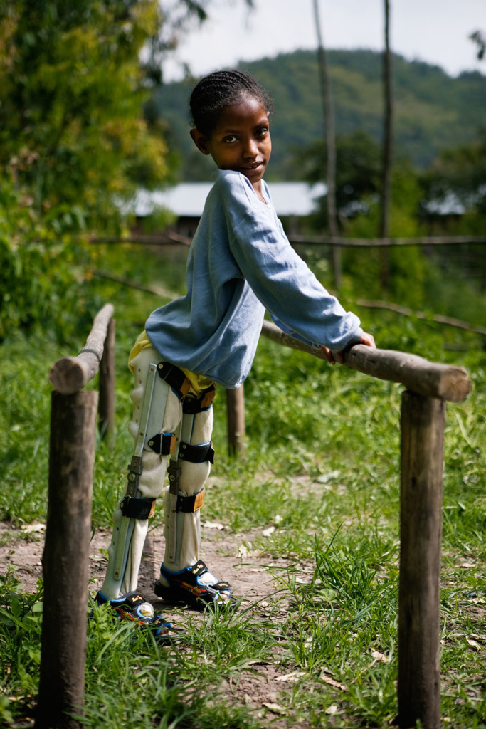 Liikuntavammainen lapsi harjoittelee kävelemään tukipuiden avulla Etiopiassa.
